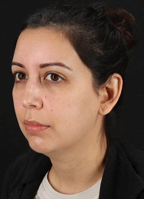 home-gallery-before@2x