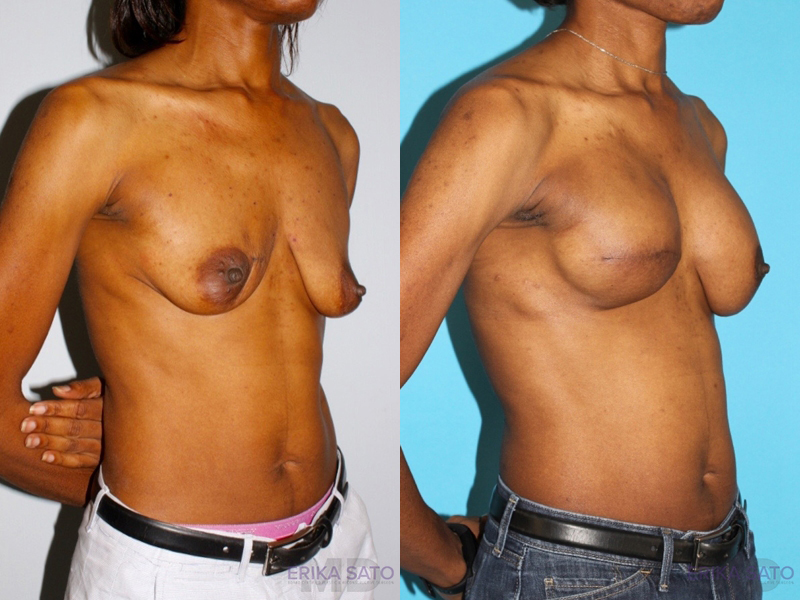 Procedure case #7909