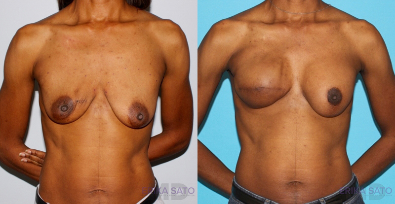 Procedure case #7909