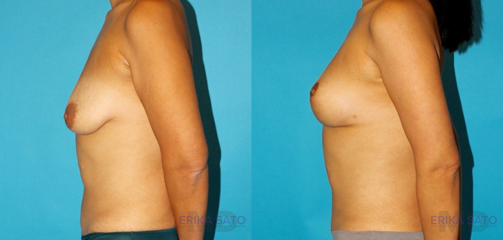 Procedure case #6965