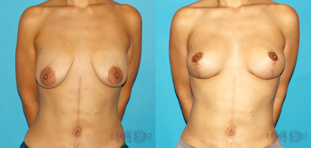 Procedure case #6965