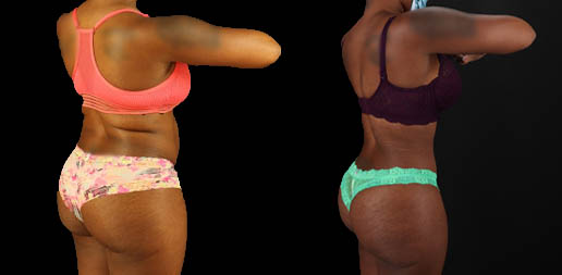 1_0001_bbl fix background (3).jpg