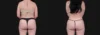 Liposuction case #266707 slider thumbnail