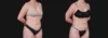 Liposuction case #266707 slider thumbnail