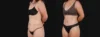 Tummy Tuck case #267116 slider thumbnail