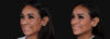 Botox® & Other Neuromodulators case #267167 slider thumbnail