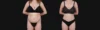 Brazilian Butt Lift case #267619 slider thumbnail