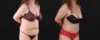 Post Bariatric Surgery (Massive Weight Loss) case #267780 slider thumbnail